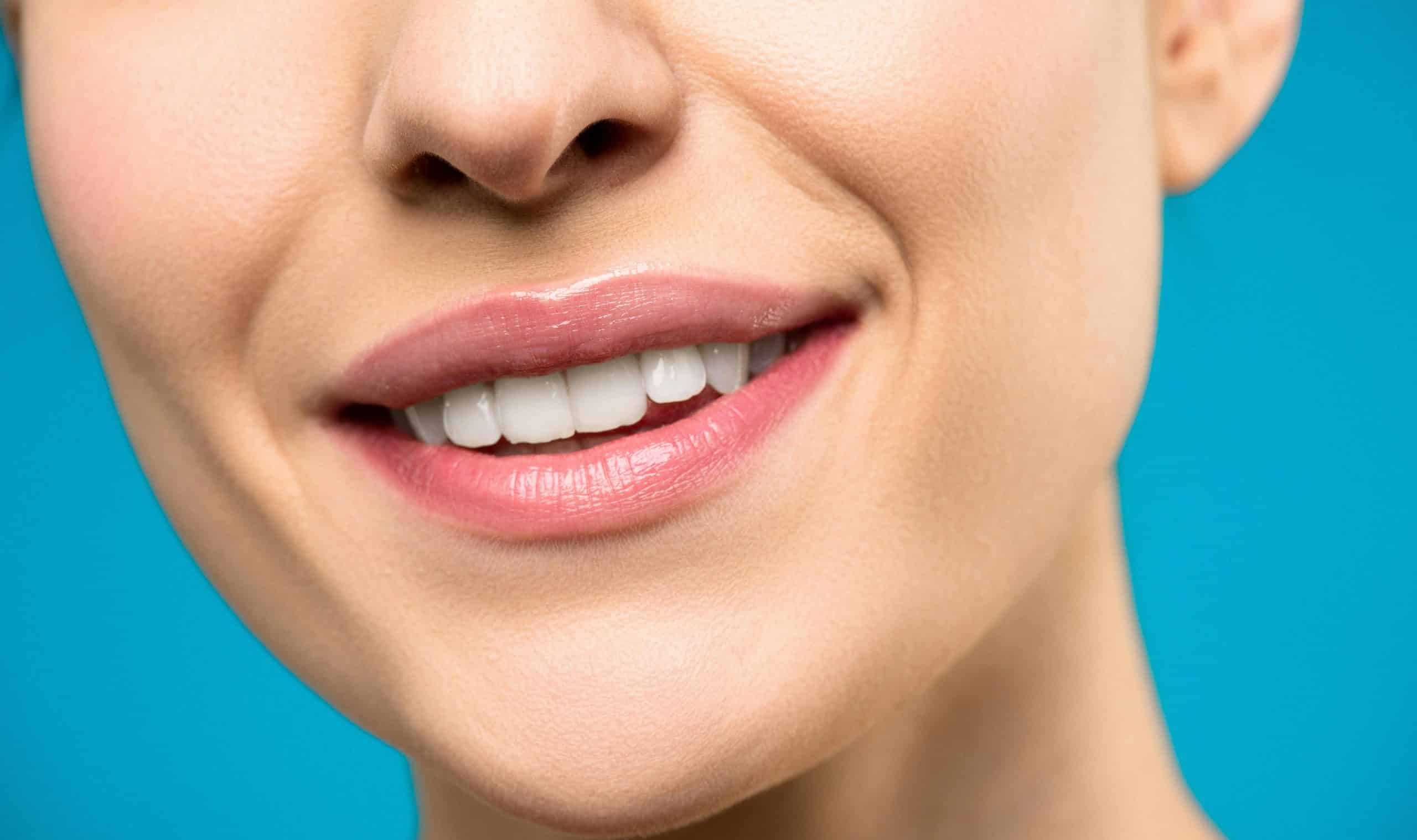 white teeth achieved from cosmetic dentistry