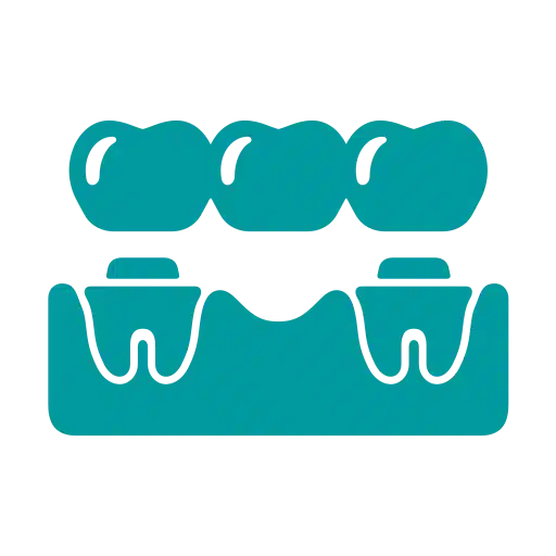 cartoon dental bridge